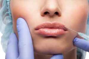 Lip Augmentation