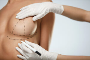 A doctor marketing a woman’s breast for a breast augmentation procedure
