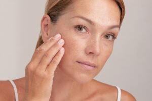 Woman with freckles and her hand on her face checking for signs of skin cancer.