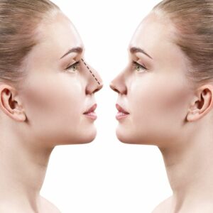 Woman looking into a mirror envisioning her enhanced appearance after rhinoplasty, showcasing potential improvements to her facial harmony