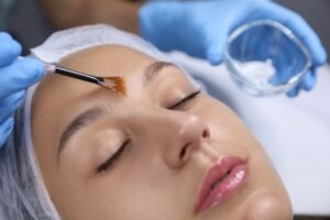 Chemical peels in Worcester, MA, at UMass Memorial Cosmetic Surgery Center rejuvenates skin. Visit us in our South Dennis, MA location for radiant results