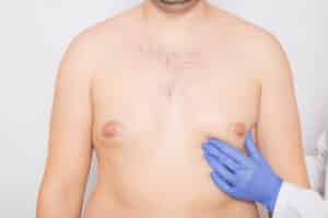 Plastic surgeon examining a male patient’s chest before gynecomastia surgery to reduce excess breast fat and improve chest contour.