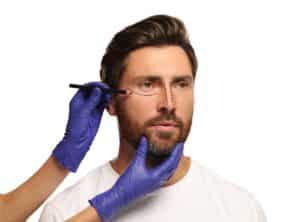 Close-up of a man preparing for cosmetic surgery as a doctor draws facial markings for a facelift against a white background