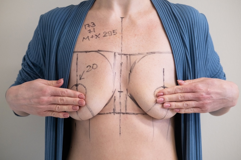 Breast Lift Worcester MA - Mastopexy Longevity South Dennis MA
