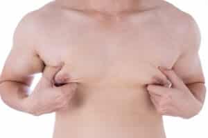 Man pressing fists into his enlarged breast tissue.