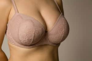 Woman with enhanced breast shape after augmentation.