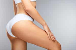 Woman showing smoother lower-body contours after body contouring surgery