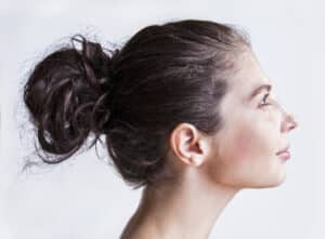 Woman showcasing improved ear shape after ear surgery.