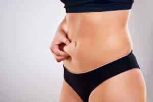 Woman holding excess abdominal skin before tummy tuck surgery.