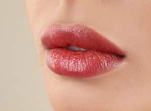 Woman with natural-looking lip augmentation results