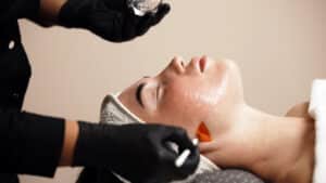 Chemical peel treatment being applied to a patient's face.